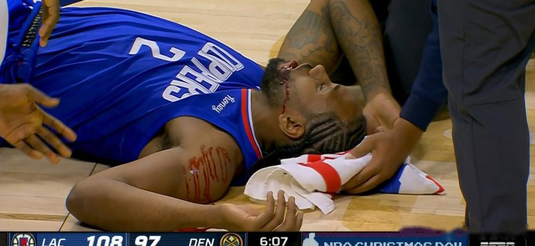 莱昂纳德什么伤？莱昂纳德被误伤？